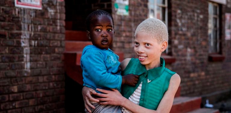 Read more about the article Being light-skinned can lead to ‘reverse colorism’ in many parts of the world